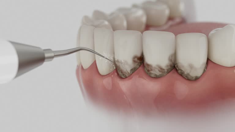 Reliable Dental contractor in Pickens, MS by Smile Center Dentistry